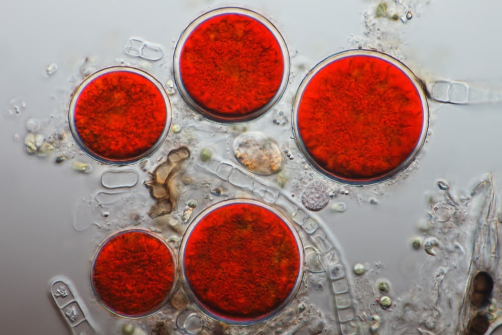 Haematococcus pluvialis cysts under the microscope